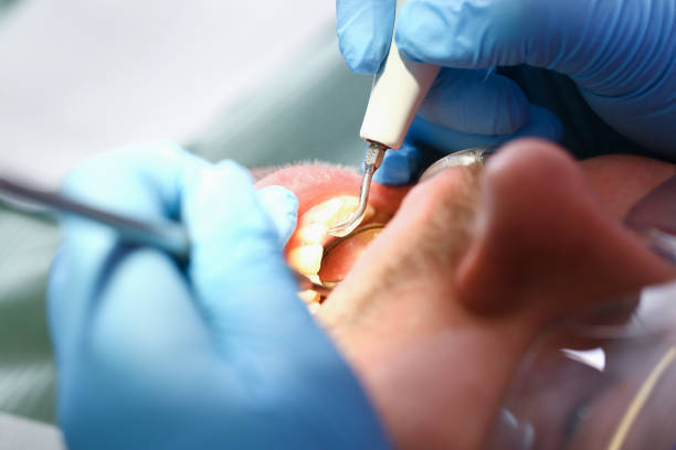 Best Urgent Care for Lost Fillings or Crowns in Akron, IA